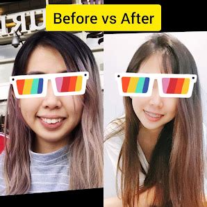 LeSmile Dental Clinic Sri Petaling (KL) 牙科 – Invisalign Braces.